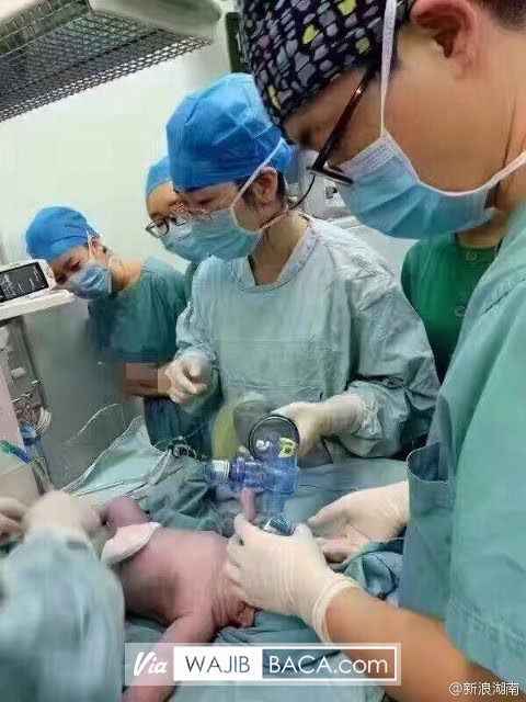 Astaga!, Dibutuhkan 16 Dokter Untuk Bantu Wanita Ini Melahirkan Karena Wanita Ini Memiliki... Astaga!, Dibutuhkan 16 Dokter Untuk Bantu Wanita Ini Melahirkan Karena Wanita Ini Memiliki...