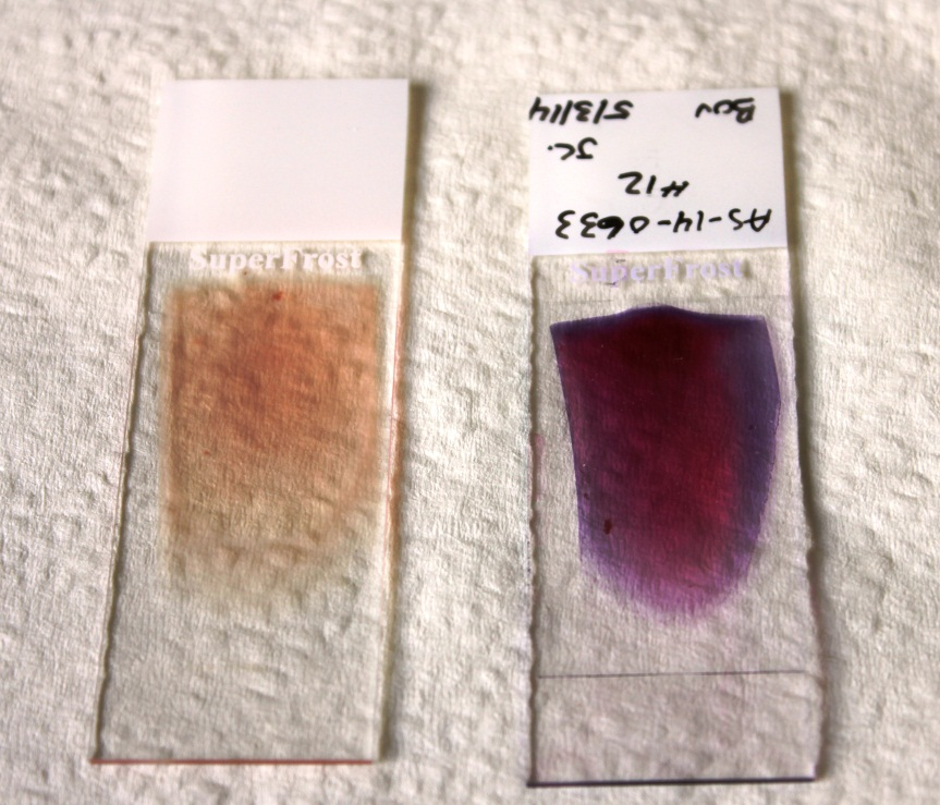 Lecture Notes in Medical Technology Lecture 13 Morphological