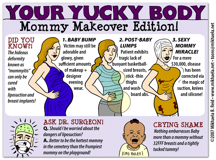 Имплантаты nobel active. Импланты титановые израильские mis c1. No more implants. No more implants. No more implants.