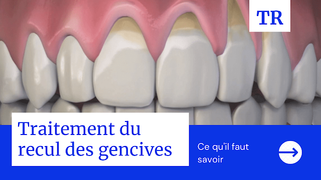 Traitement du recul des gencives