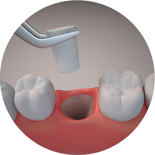 Overview Of Pharmaceutical Dental Cones Tablet
