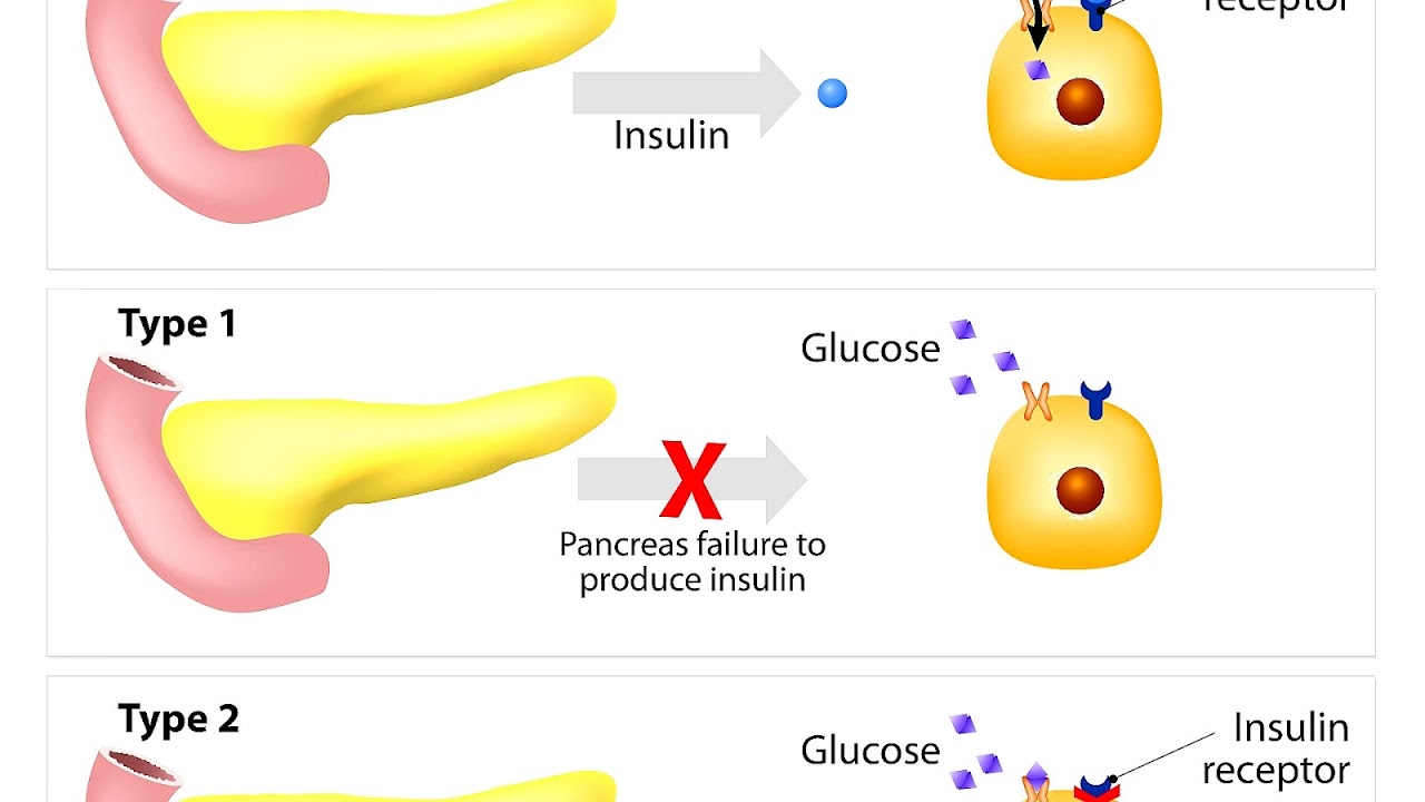 Insulin Is Produced In The Insulin Choices