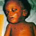 17 Month-Old Baby Dies After Drinking Kerosene