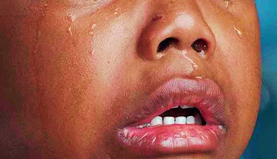 BARBARIDADE: Mãe é presa após cegar três filhos para receber benefícios do INSS