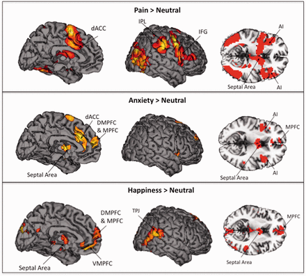 EMPATHIC BRAIN PDF EMPATHIC BRAIN PDF