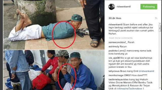 Netizen Ramai-ramai Doakan Pria yang Diposting Ridwan Kamil Tangannya Benar-benar Buntung