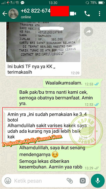 Cara Mengobati Varises Secara Alami dan Cepat Sampai Sembuh Total Cara Mengobati Varises Secara Alami dan Cepat Sampai Sembuh Total