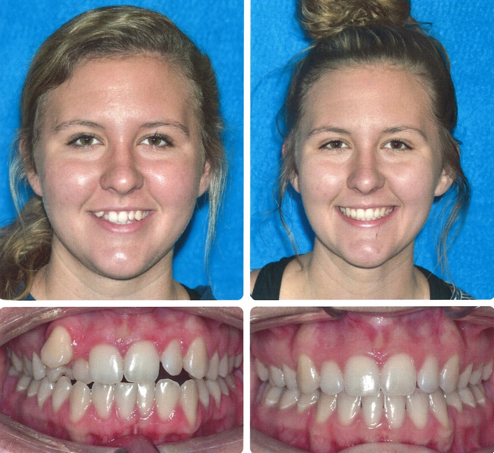 Embracing Innovative Orthodontics Portage, Kalamazoo, Paw Paw, MI