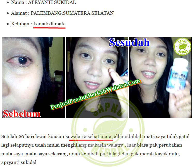 Cara Mengobati Sakit Mata Saat Berkedip Secara Alami Terbukti Manjur ~ TESTIMONI SEHAT MATA SOFTGEL Cara Mengobati Sakit Mata Saat Berkedip Secara Alami Terbukti Manjur ~ TESTIMONI SEHAT MATA SOFTGEL