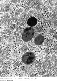 Electron micrograph showing four dark secondary lysosomes surrounded by numerous mitochondria.