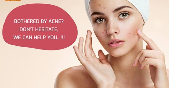 best acne treatment chennai