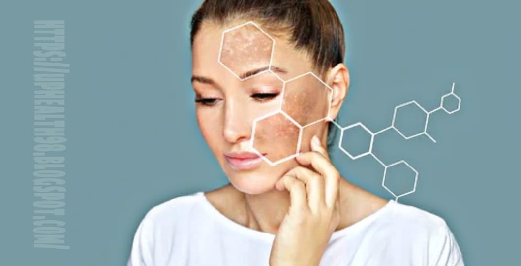 Best remedies For Dark Spots