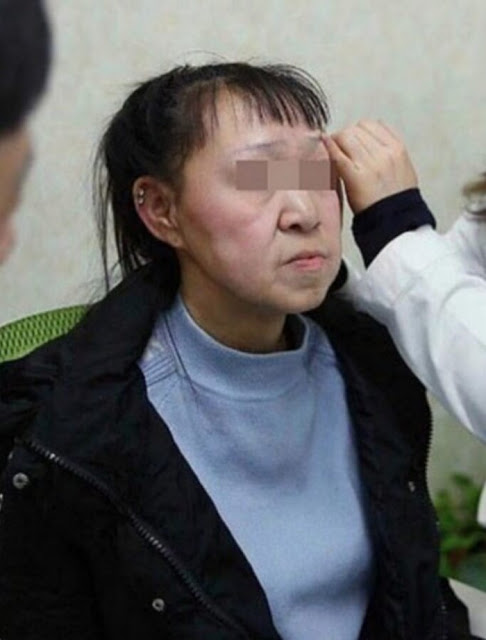 15-летняя китаянка бросила школу, стесняясь своего вида