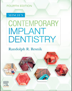 Misch’s Contemporary Implant Dentistry 4th Edition – 2021 Misch’s Contemporary Implant Dentistry 4th Edition – 2021