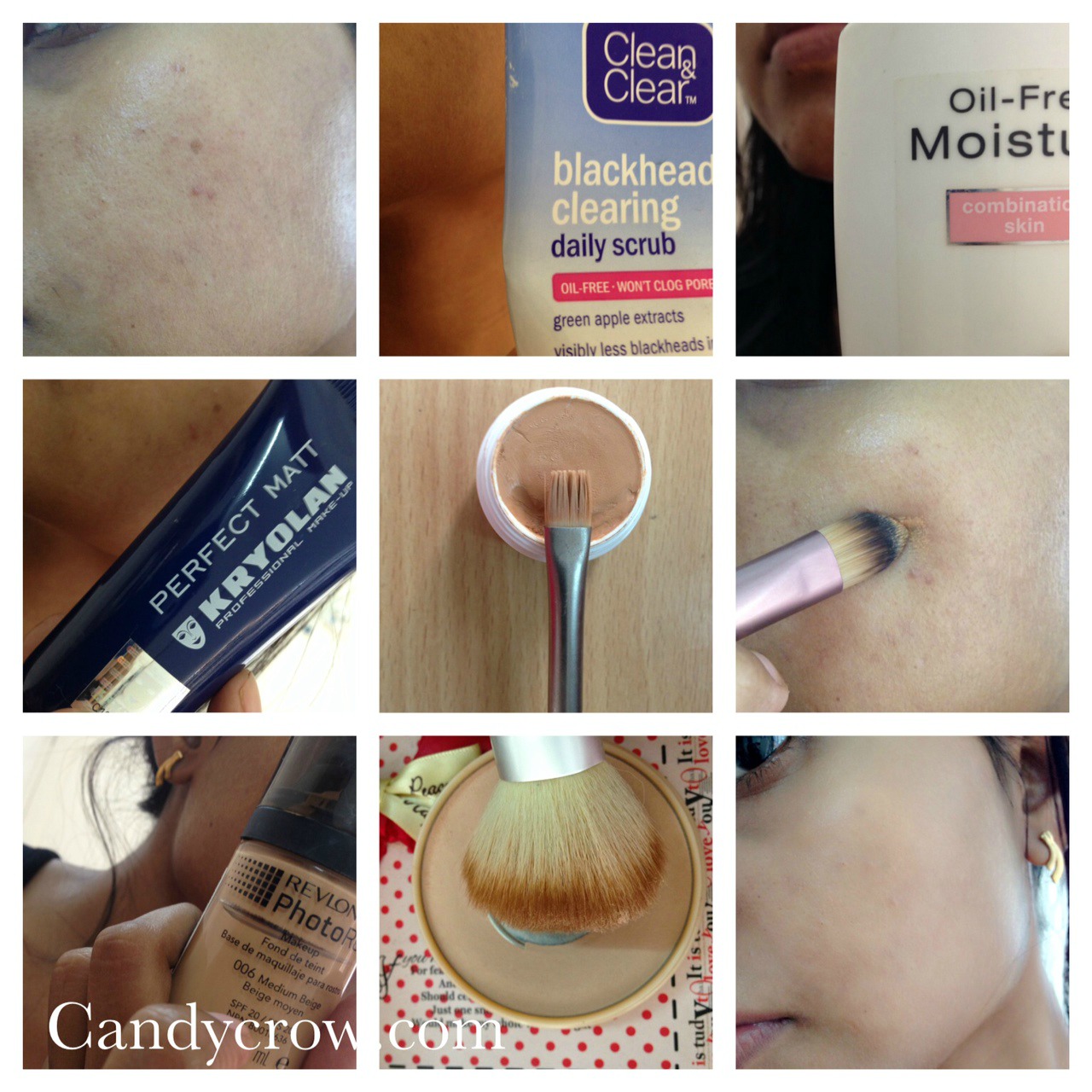 How to Cover Blemishes and Acne Scars with Makeup ? with photos