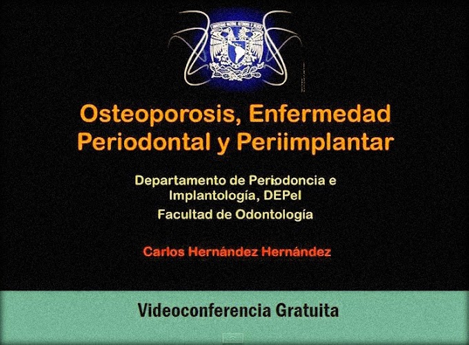 OSTEOPOROSIS: Enfermedad Periodontal y Periimplantar - Videoconferencia del Dr. Carlos Hernández 