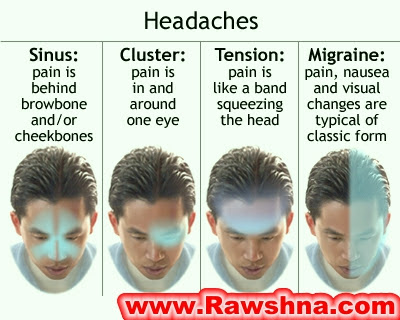انواع صداع الرأس والطرق المختلفة للتفريق بينهم