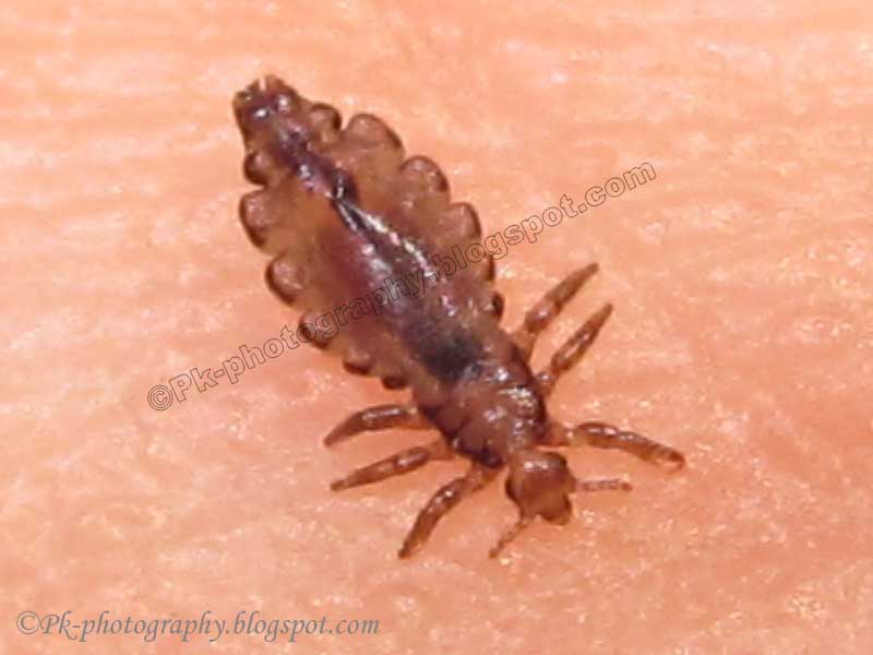 Head Lice Pictures 99