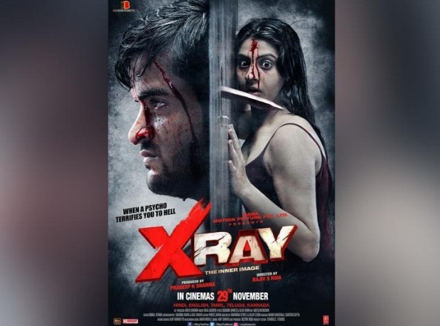 Higher Song X Ray (The Inner Image) – wapinda Bhavin, Sameeksha, Vishal Status Mp4 HD Video WapWon Higher Song X Ray (The Inner Image) – wapinda Bhavin, Sameeksha, Vishal Status Mp4 HD Video WapWon