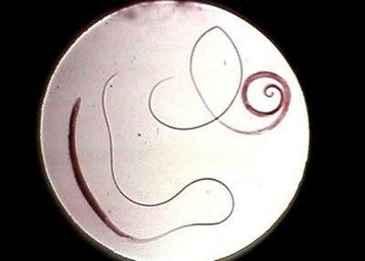 Trichuris+trichiura++adult.jpg