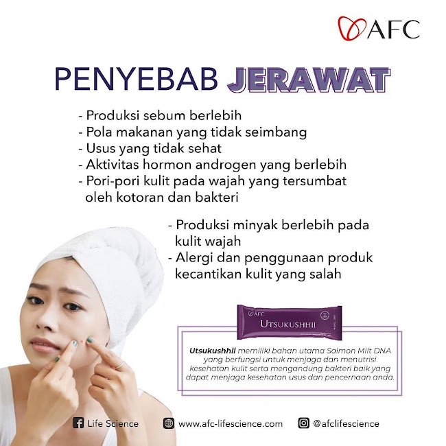 AFC Salmon SOP Subarashi: Cara Stem Cell Therapy yang Murah dan Halal<br/> AFC Salmon SOP Subarashi: Cara Stem Cell Therapy yang Murah dan Halal<br/>.