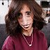 Lizzie Velasquez: πρέπει να τρώει κάθε 15′