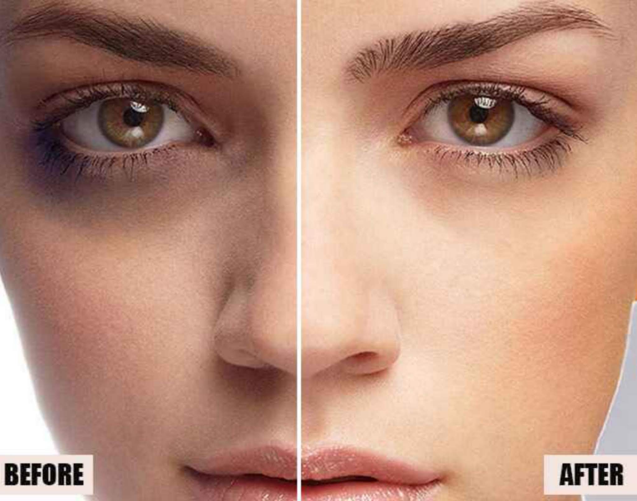 How to Get Rid of Black Circles Under Eyes Permanently Home Remedies