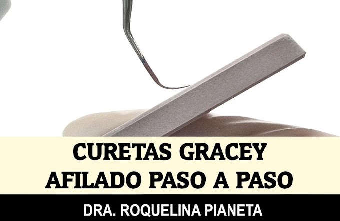 CURETAS GRACEY: Afilado paso a paso - Dra. Roquelina Pianeta
