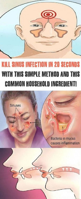 Kill Sinus Infection in 20 Seconds with This Simple Method and This Common Household Ingredient!