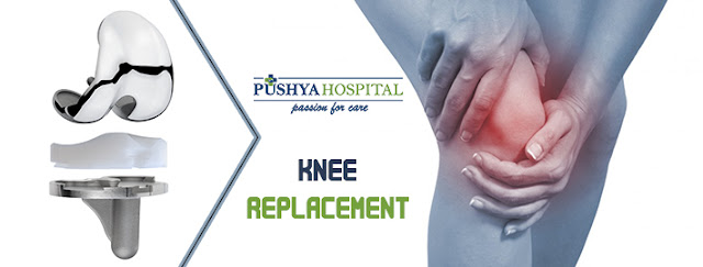 Best Knee Replacement Surgeon In Ahmedabad