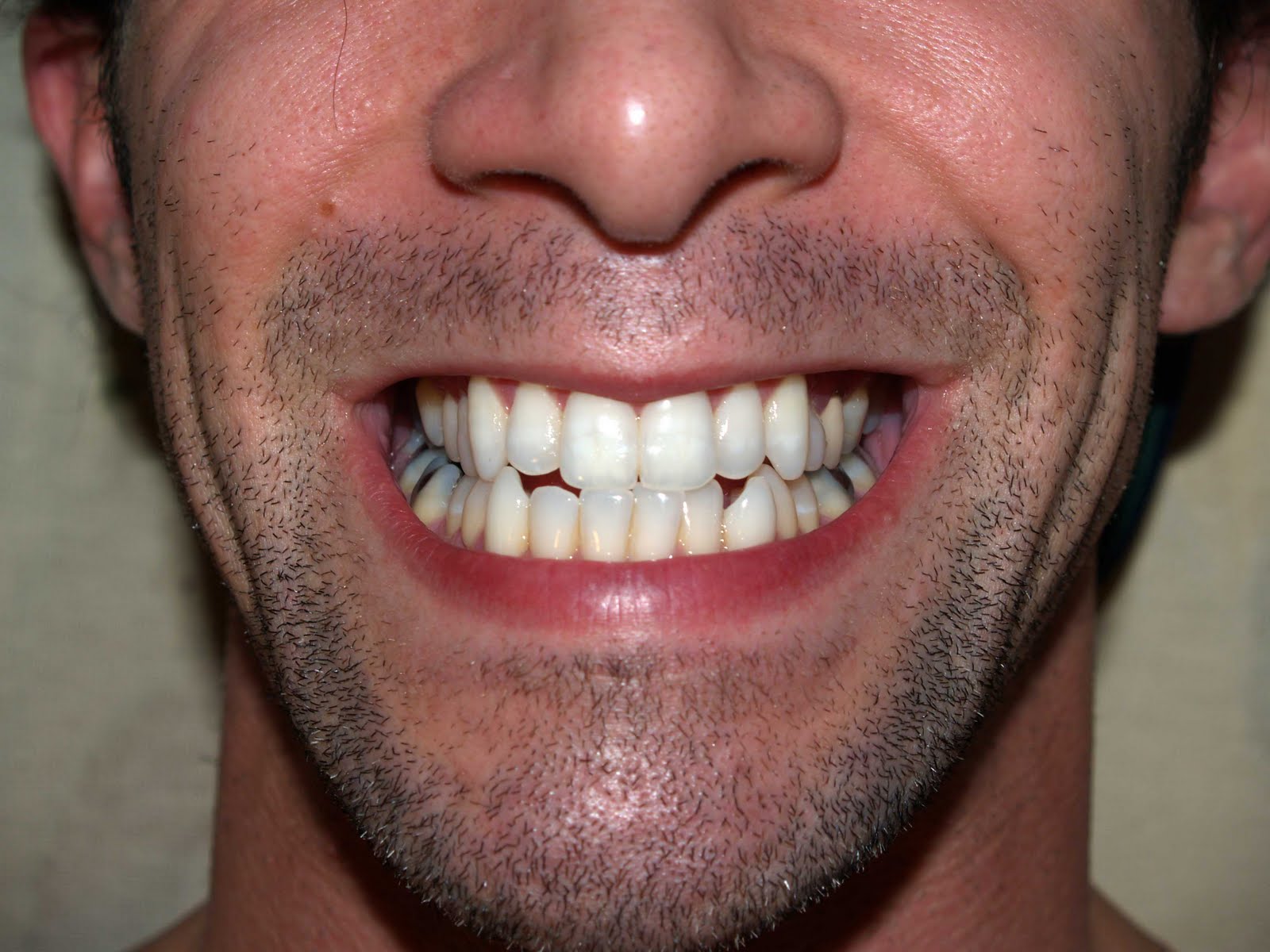 Форма зубов клыки. Идеальные зубы. Зубы мужские. Ровные зубы с клыками. Ровные зубы мужские.