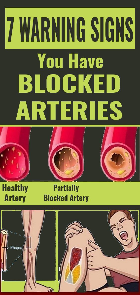 Here Are 7 Warning Signs You Have Blocked Arteries Wellness Know
