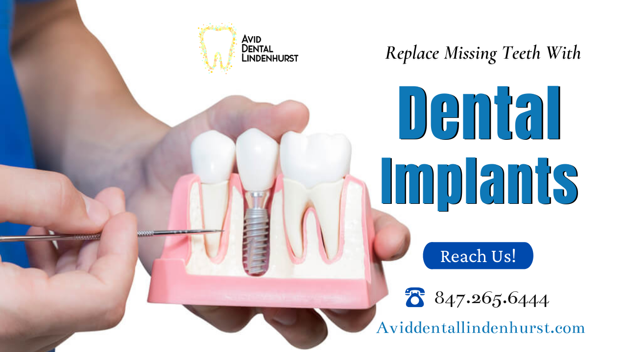 Replace Missing Teeth With Dental Implants
