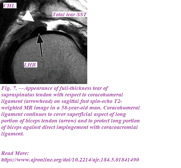 MRI of the Rotator Interval Capsule