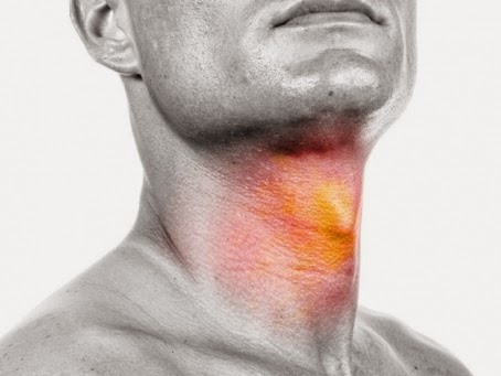 cara menyembuhkan sakit radang tenggorokan secara alami 