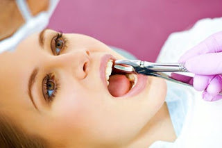 nhổ răng hàm bị sâu có ảnh hưởng gì không?
