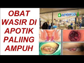 "10 merk obat wasir paling manjur" by obat kutil