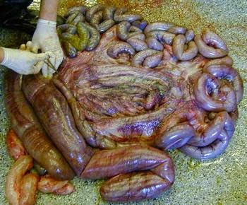 Restaurant Raided By Police And Closed For Serving Human Flesh