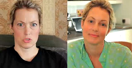 Ali Wentworth Plastic Surgery Before and After Eyelid Surgery and ...