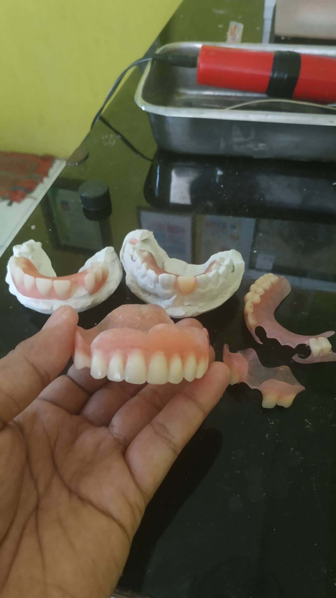 ARIFFINDRA DENTAL AHLI GIGI PURWOKERTO: Memasang gigi palsu yang baik