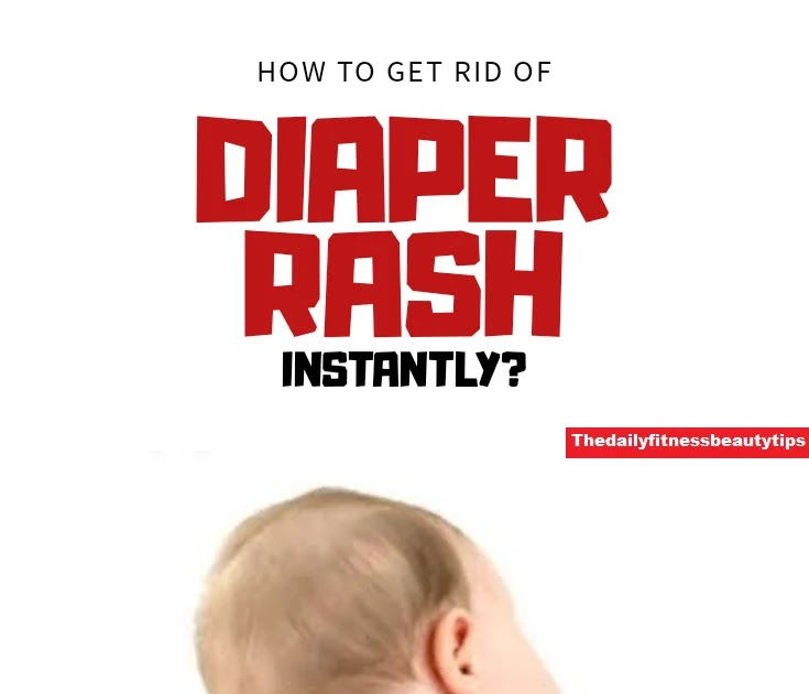 How To Get Rid Of Diaper Rash In 24 Hours?