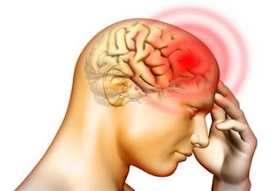 Tìm hiểu nguyên nhân chứng đau nửa đầu và hướng điều trị
