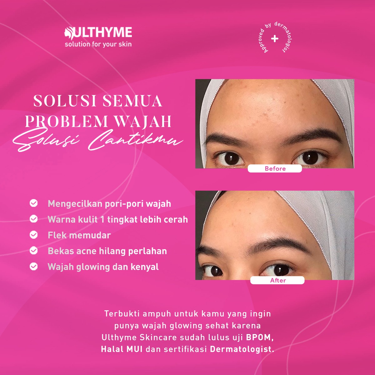 ulthyme skincare