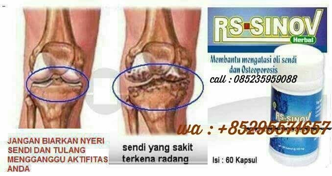 Cara Mengobati Bengkak Di Lutut Ayam Harga Ulasan Bahan Komposisi