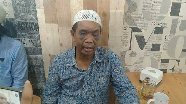 Habis Digebuki, Diinjak dan Disiksa Polisi, Kuli Bangunan Sarpan Disetrum Habis Digebuki, Diinjak dan Disiksa Polisi, Kuli Bangunan Sarpan Disetrum