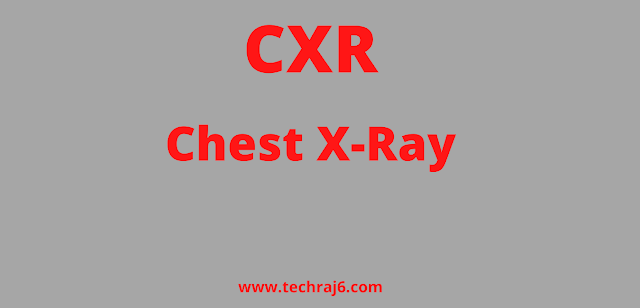 CXR full form, What is the full form of CXR