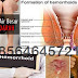 NAMA OBAT WASIR HERBAL: AMBEJOSS DE NATURE thumbnail