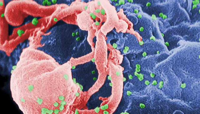 ВИЧ-инфекция/СПИД, с 1980 года по настоящее время