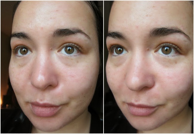 Clinique Superprimer Collection Review; Before and After Photos ...