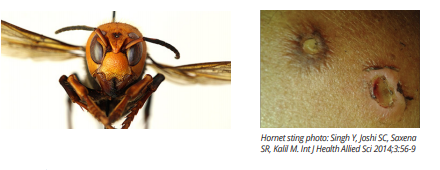 Vespa mandarinia Asian Giant Murder Hornet Found in USA